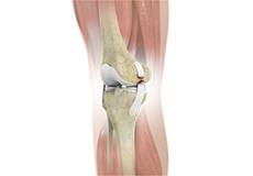Ligament Injuries